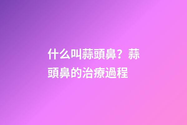 什么叫蒜頭鼻？蒜頭鼻的治療過程