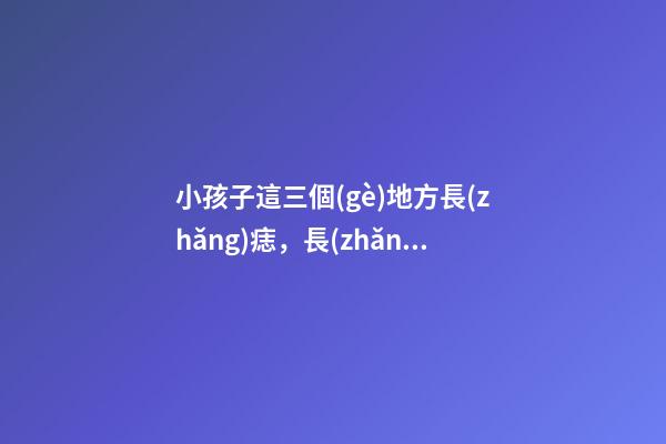 小孩子這三個(gè)地方長(zhǎng)痣，長(zhǎng)大后必定出人頭地