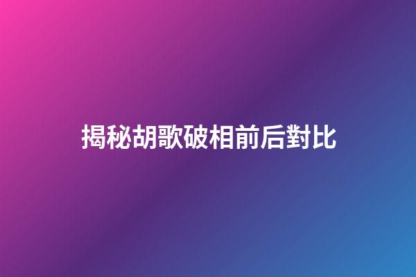 揭秘胡歌破相前后對比
