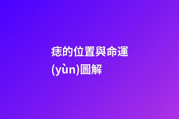 痣的位置與命運(yùn)圖解