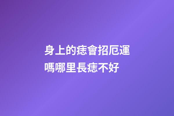 身上的痣會招厄運嗎?哪里長痣不好?