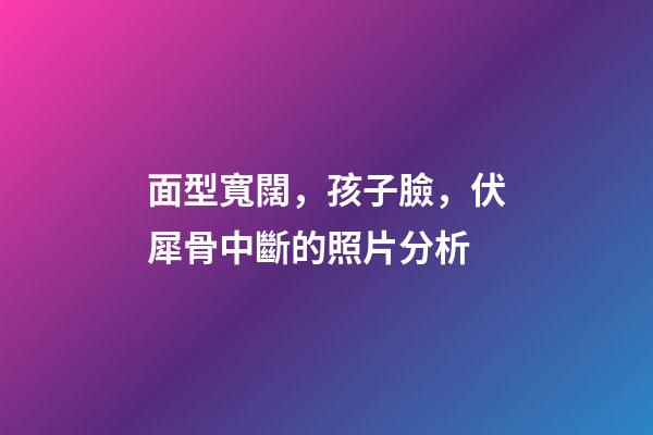 面型寬闊，孩子臉，伏犀骨中斷的照片分析